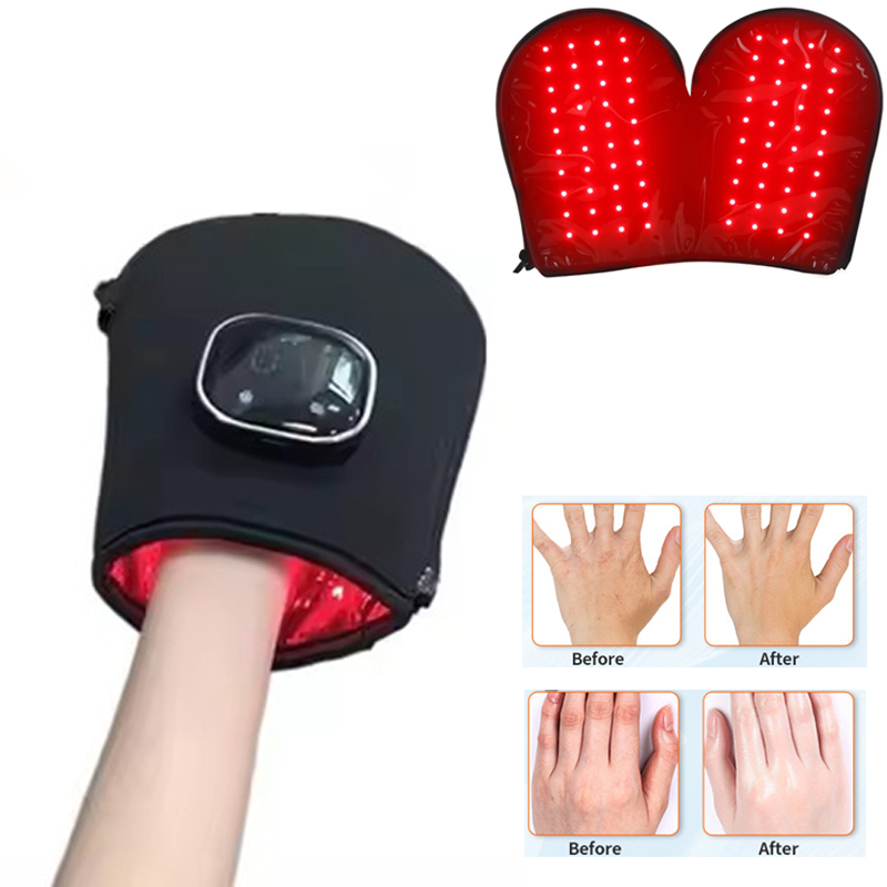 НОВЫЙ Аппарат для светотерапии – обзор и цена Heated Gloves Electric